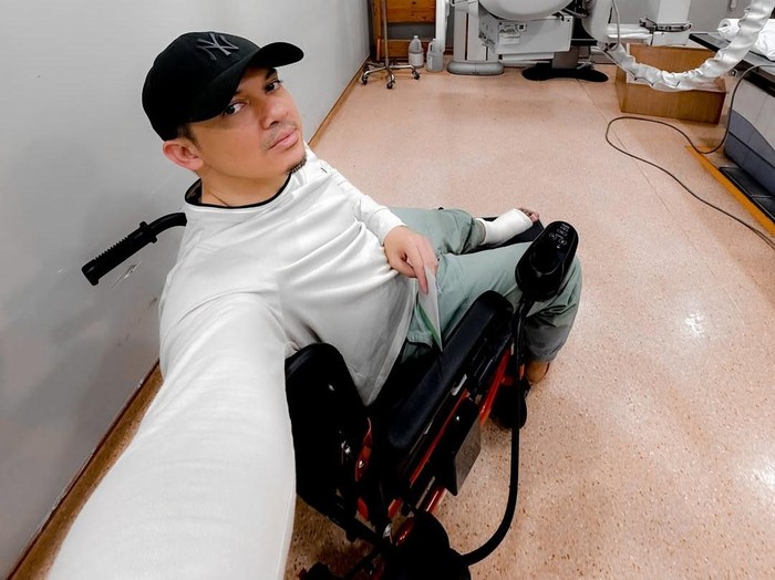 Irwansyah Cedera Kaki, Main Bareng Anak Terhenti?